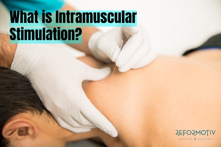 What is Intramuscular Stimulation